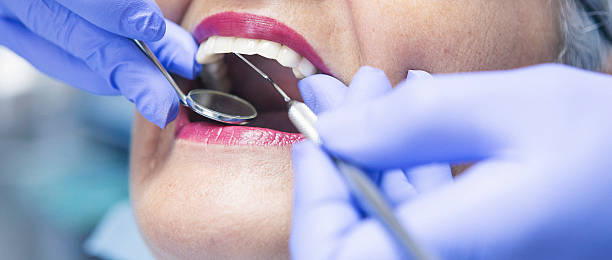 Best Chipped Tooth Repair Near Me  in Summerville, SC